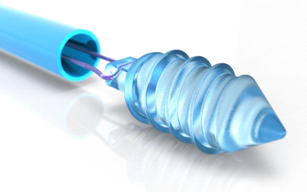 Bioabsorbable anchor assembly