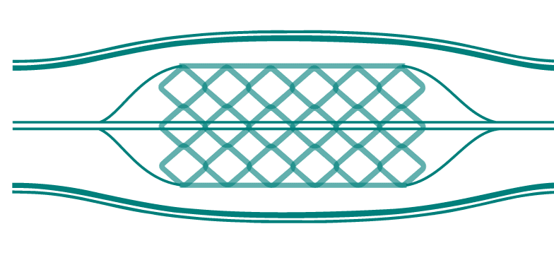 Illustration of medical implant mesh